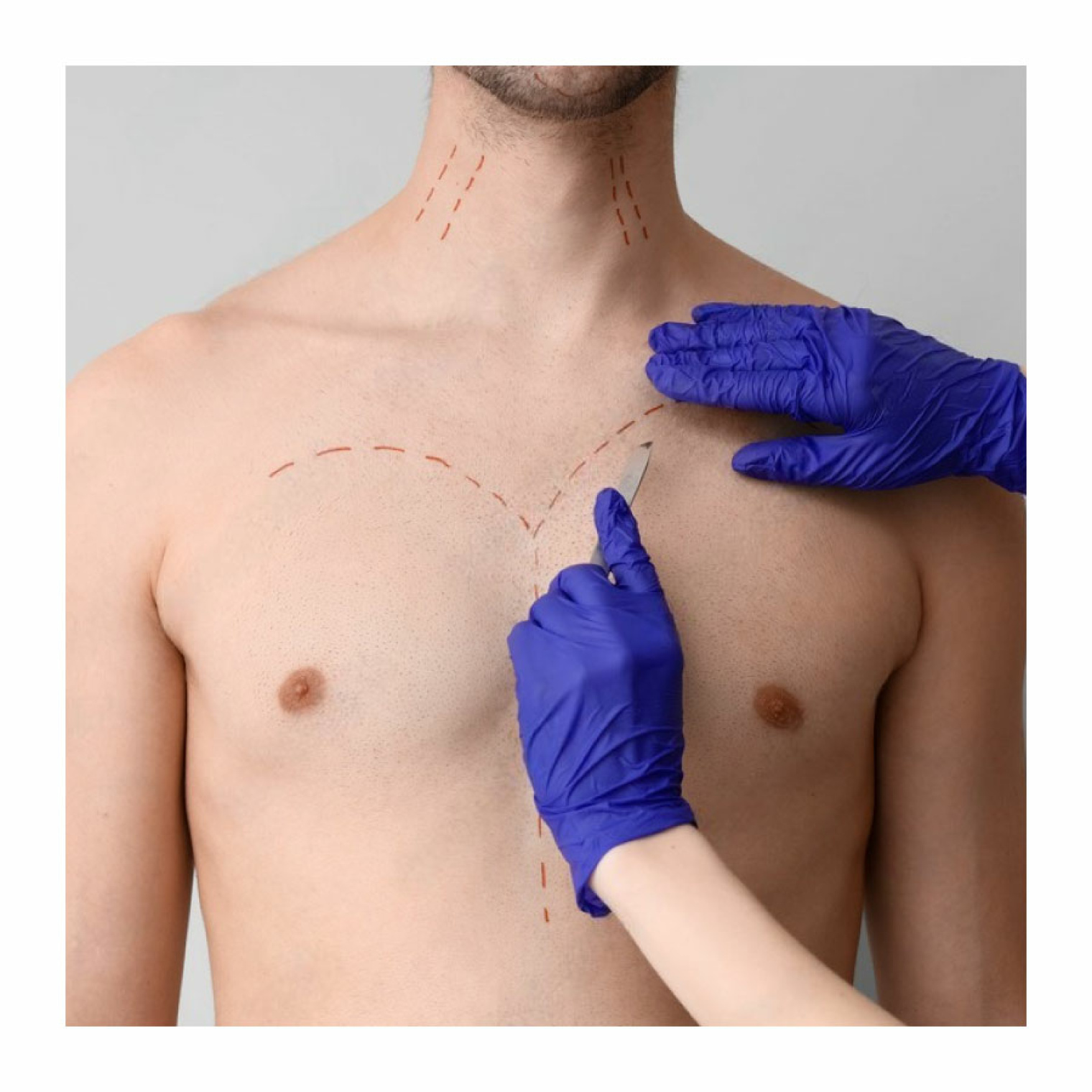 Показання до застосування