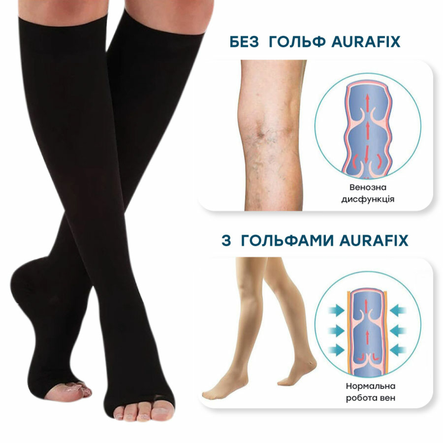 <span>Профілактика варикозного розширення вен</span>