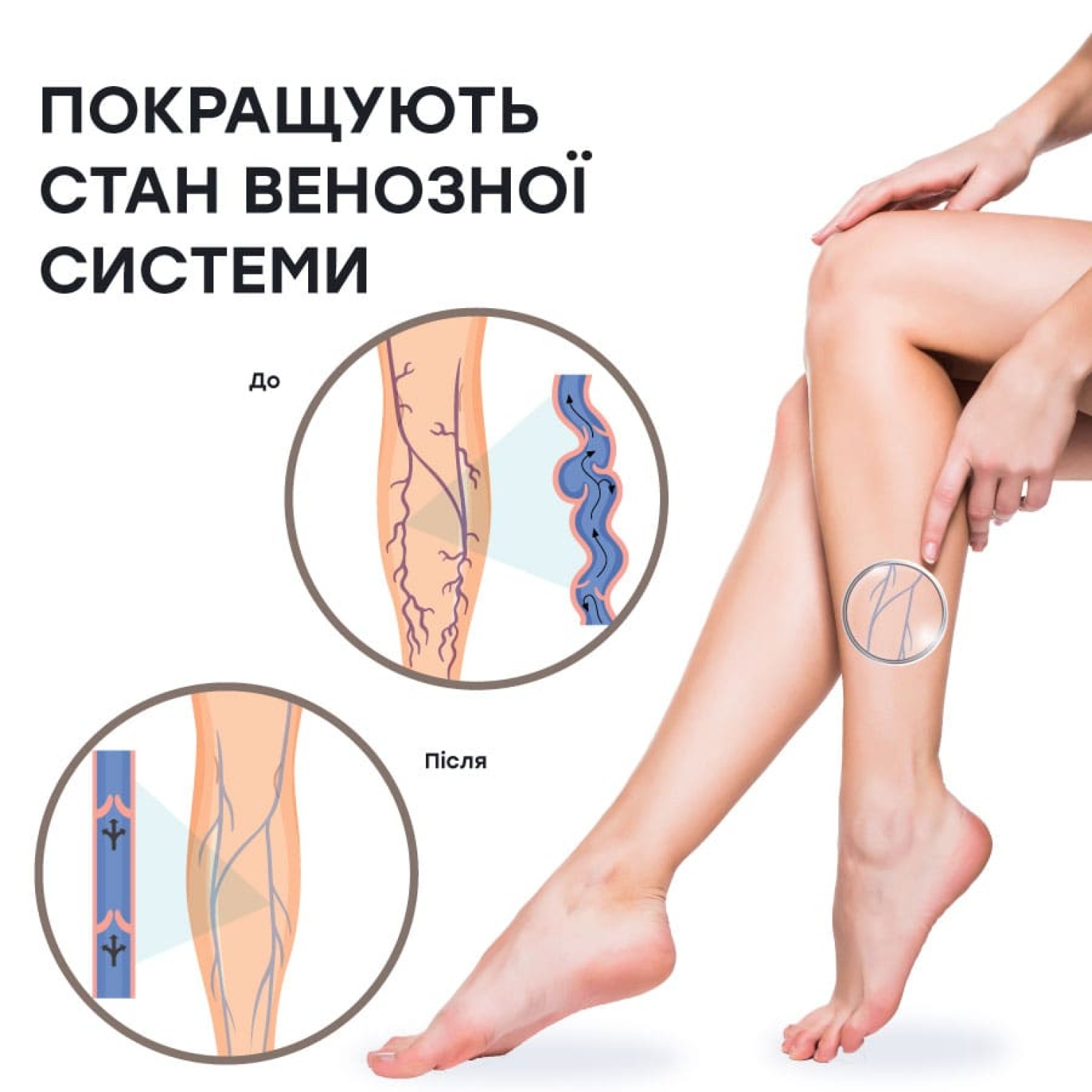 <span>Профілактика варикозного розширення вен</span>