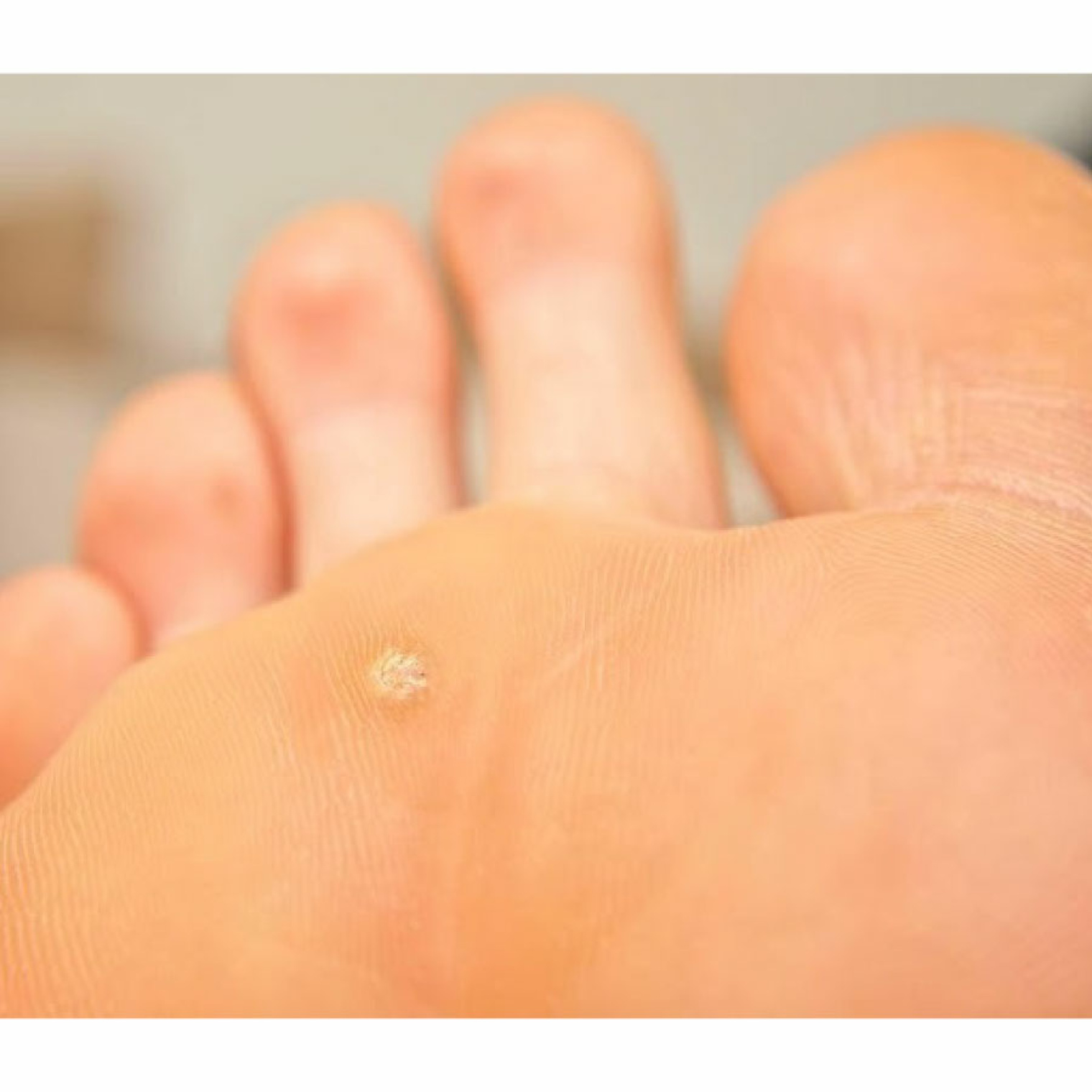 <span data-mce-style="color: rgb(52, 73, 94);" style="color: rgb(52, 73, 94);">Показання до застосування</span>