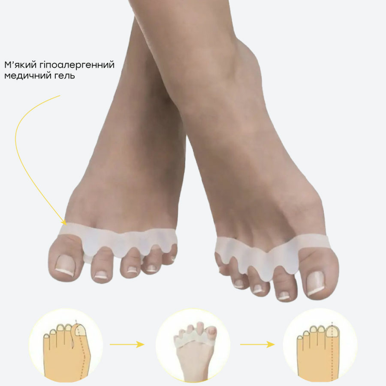 <span data-mce-style="color: rgb(0, 0, 0);" style="color: rgb(0, 0, 0);">Особливості роздільника</span>