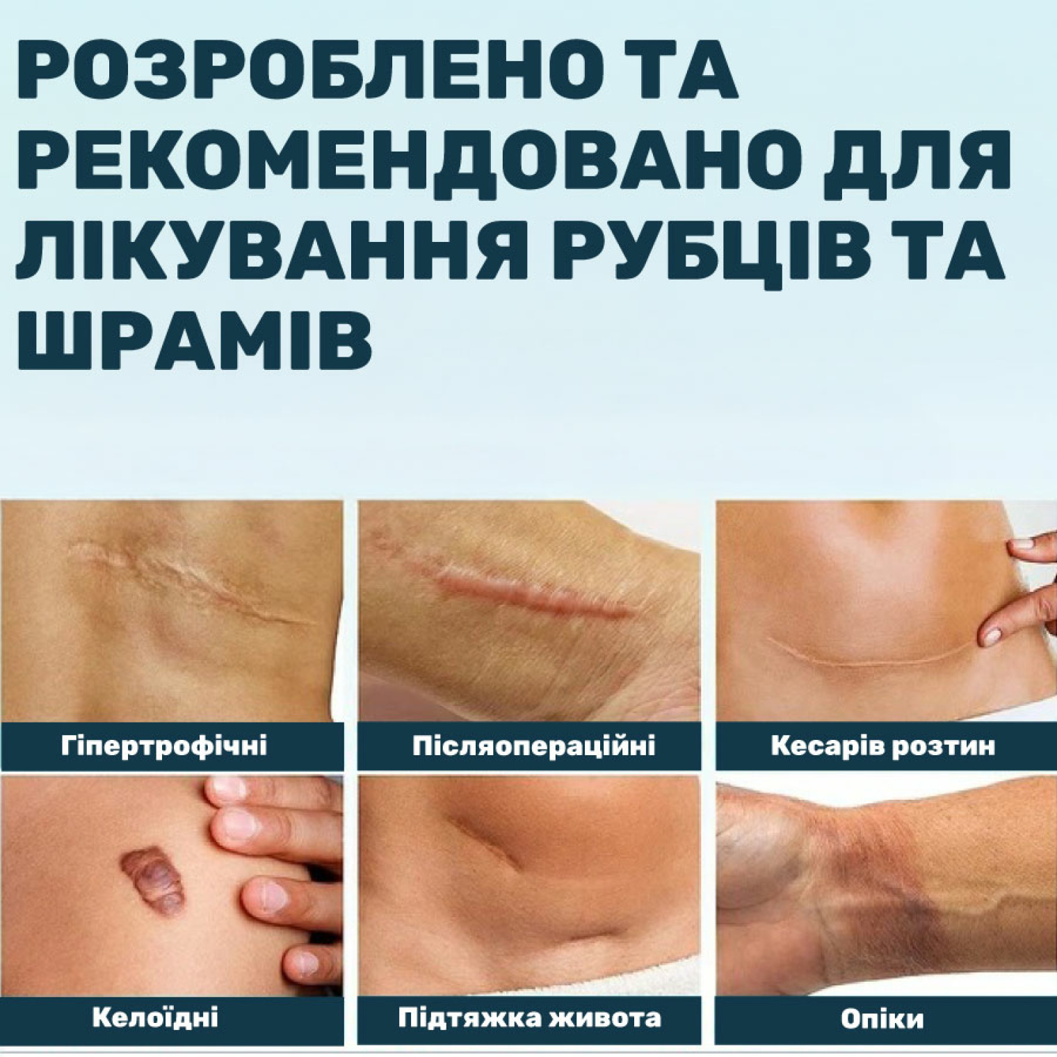 <span data-mce-style="color: rgb(0, 0, 0);" style="color: rgb(0, 0, 0);">Призначення пластиря&nbsp;Ortomedica</span>