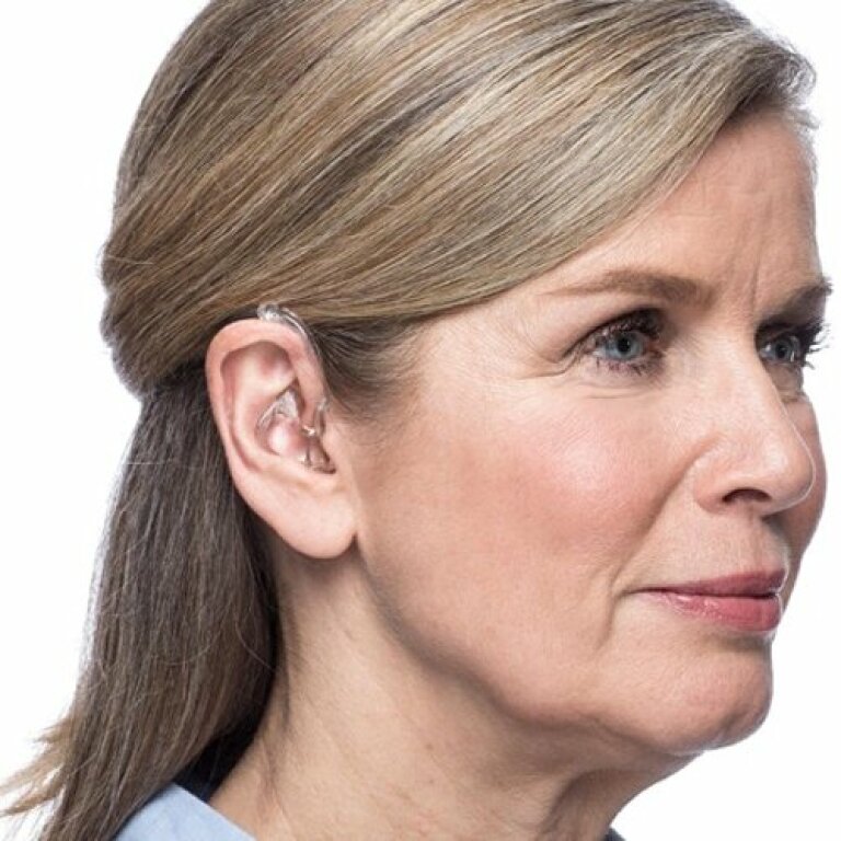 Слуховой аппарат Widex DREAM Fashion D-FA BTE, модель 30