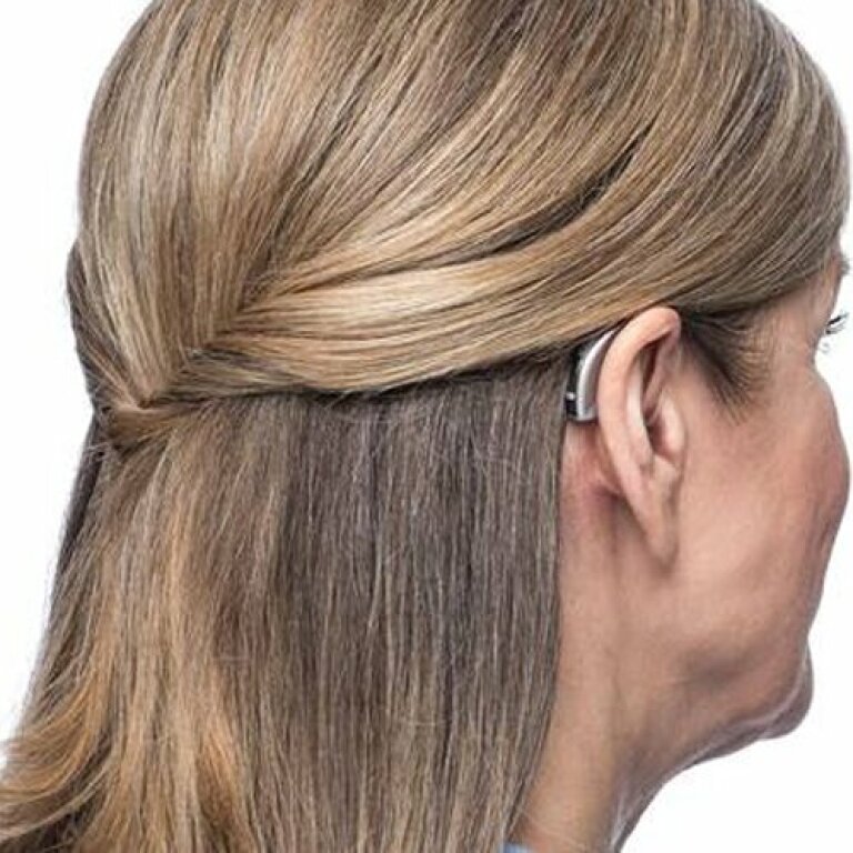 Слуховой аппарат Widex UNIQUE Fashion Mini U-FM (RC) - модель 30