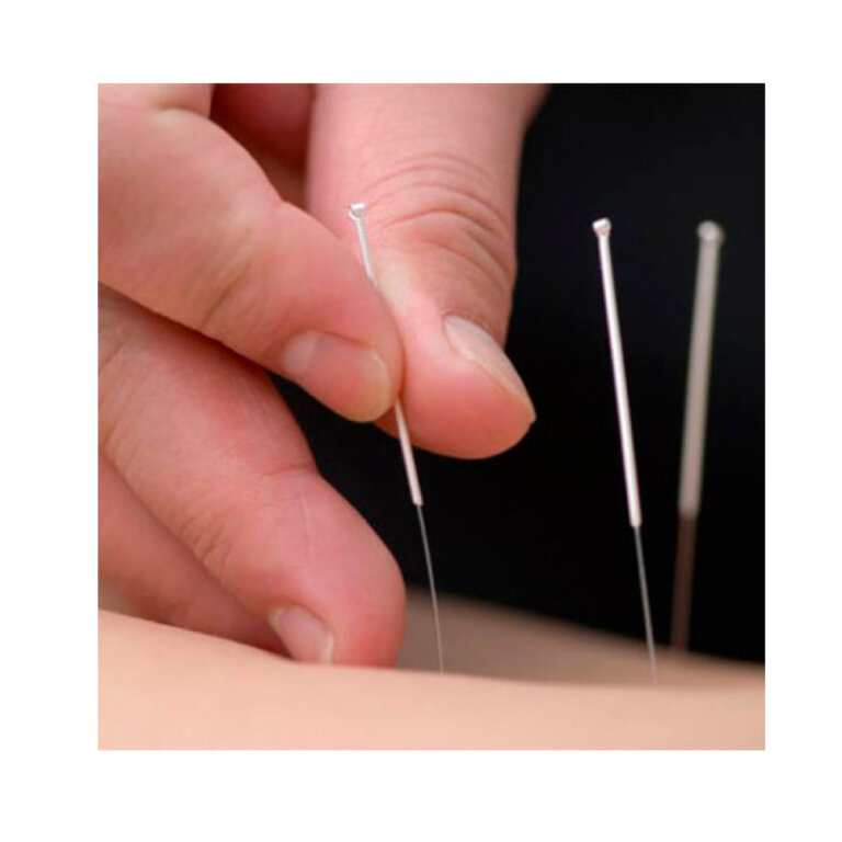 Стерильні голки для акупунктури SAN-25-25-1000 (0,25 х 25 мм )