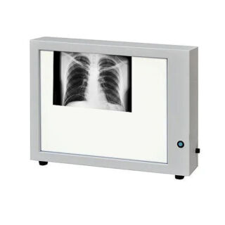 Негатоскоп (світлове поле 415х315) Заповіт НТ-48М