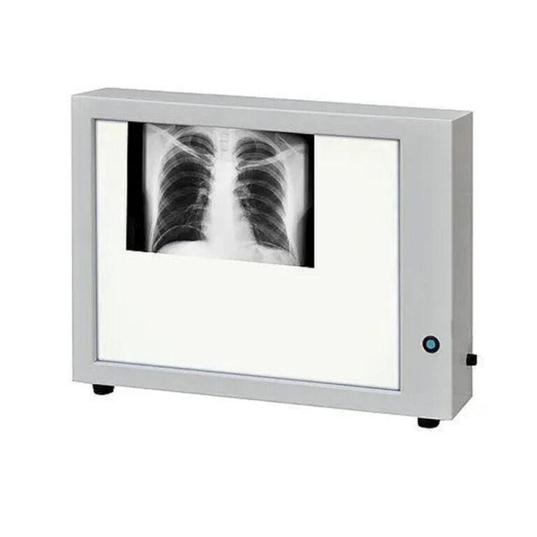 Негатоскоп (світлове поле 415х315) Заповіт НТ-48М