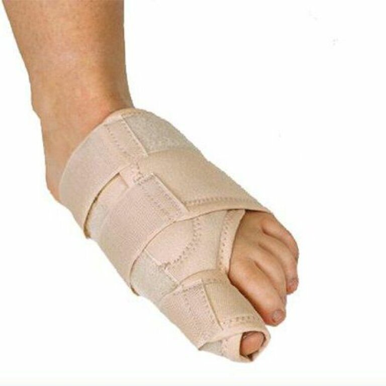 Ортез Orliman HV-30 правий при вальгусній деформації першого пальця стопи, жорсткий