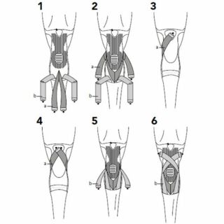 Лігаментарний ортез Thuasne Ligastrap Genu 2170 з функціональними ременями