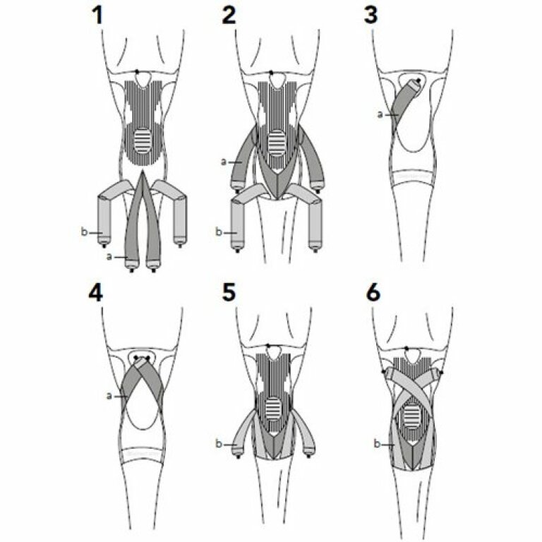 Лігаментарний ортез Thuasne Ligastrap Genu 2170 з функціональними ременями