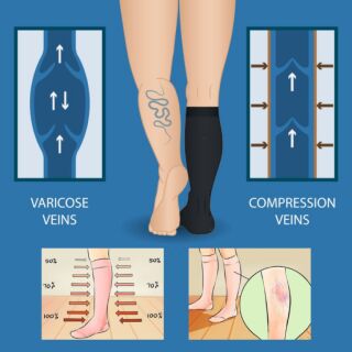 Компресійні гольфи Aurafix AV-100, 1 клас, з відкритим носком, чорні