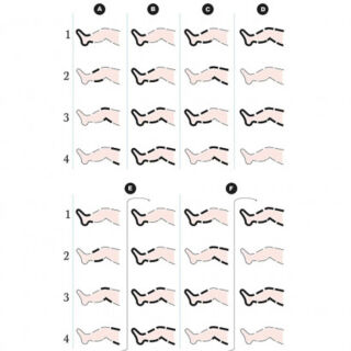 Лимфодренажный аппарат 6 камер OSD-FO-3001